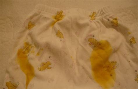 Stain Removal 101 Baby Poop