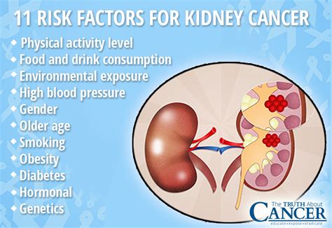 In time, signs and symptoms may develop, including Kidney Cancer Causes: 11 Factors Putting You at Risk
