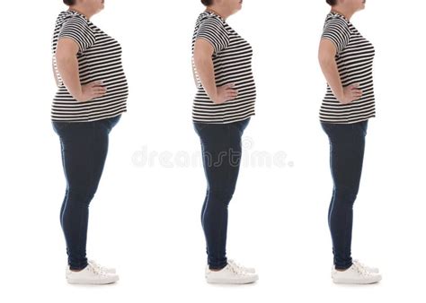 Woman Before And After Weight Loss On White Background Collage Stock