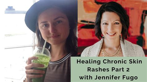 Healing Chronic Skin Rashes Part 2 With Jennifer Fugo Youtube