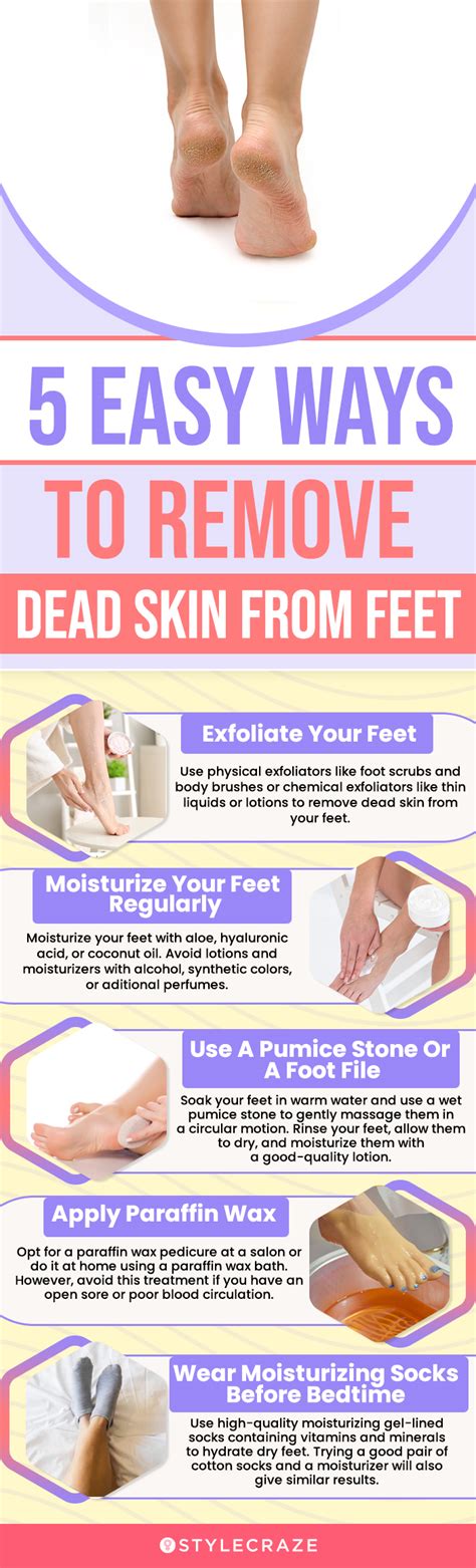 Easy Steps To Remove Calluses From Feet For Glowing Skin Removemania