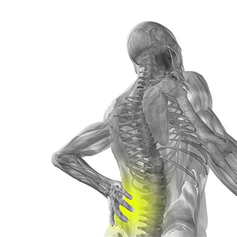 Spinal Cord Compressioninjury Top Spine Surgeon Manhattan