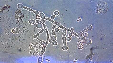 Fungal Pathogens Part 1 Of 2 Youtube