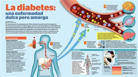 POSTPOLIO SINDROME IGNORADO La Diabetes Sintomas Causas Tratamiento