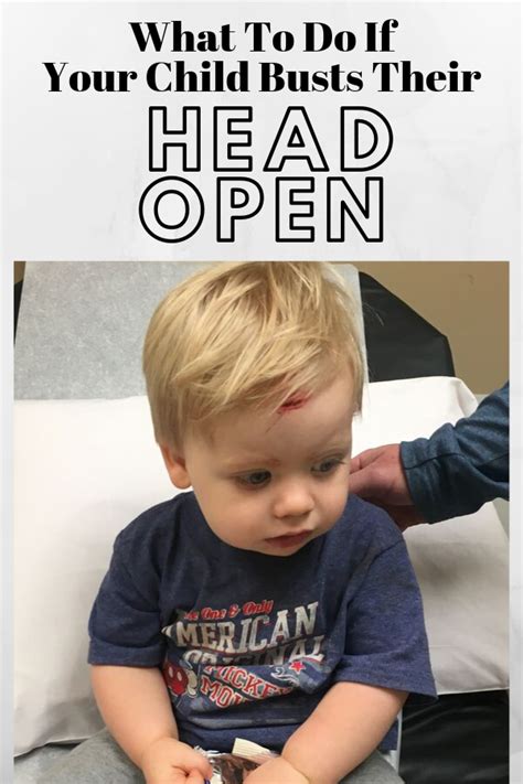 Baby And Toddler Head Injury How To Be Prepared Toddler Head Injury