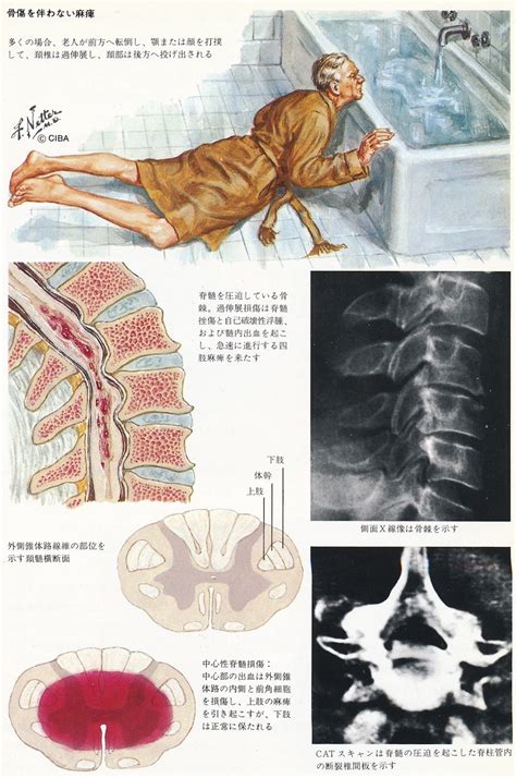 The Morbidly Beautiful Medical Illustrations Of Dr Frank Netter