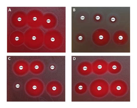 Figure 2 [unusual Phenotypes Of Mls Resistance ] Streptococcus Pyogenes Basic Biology To