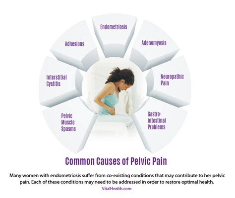 Causes Of Pelvic Pain Vital Health Endometriosis Center