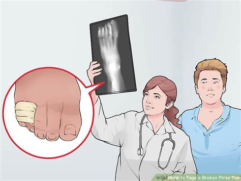 23 yrs old female asked about pinky toe in pain, 1 doctor answered this and 34 people found it useful. How to Tape a Broken Pinky Toe: A 5-Step First Aid Guide ...