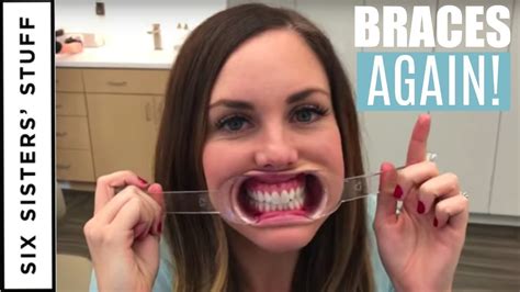 Adult Braces Vs Invisalign My Orthodontist Consultation Youtube