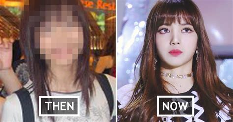 Fans Share Proof That Blackpink Lisa Never Did Plastic Surgery