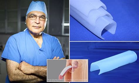 BidexMedia New Hope For Men Wanting To Enlarge Their Manhood Silicone Penis Implant Adds Two