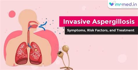 Invasive Aspergillosis Symptoms Risk Factors And Treatment By
