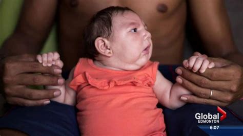 What Pregnant Women Need To Know About Zika Virus And Travel