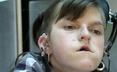 Mother Fights For Best Care For Handicapped Teenage Daughter Globalnewsca