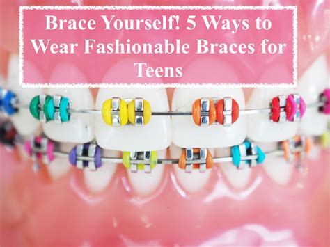 Brace Yourself 5 Ways To Wear Fashionable Braces For Teens