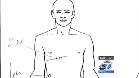 Ezell Ford Autopsy 2 Experts Review Report Abc7 Los Angeles
