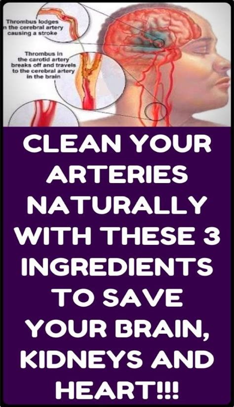 how to clean out plaque in arteries 3 ingredients mixture healthyload u almog zbidat