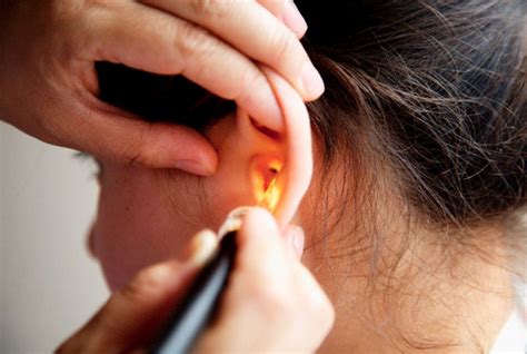 Earwax Causes Facts Treatments Ear Syringing And Microsuction The