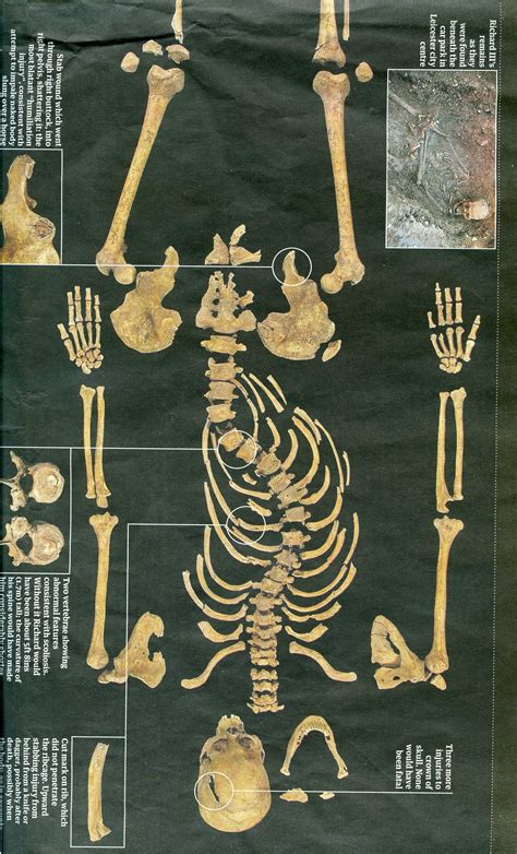King Richard Iii Skeleton Richard Iii English History Tudor History