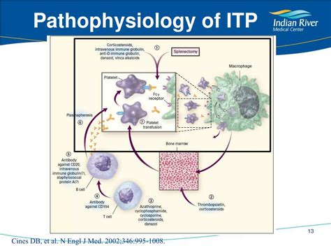 Idiopathic Thrombocytopenic Purpura Diagram