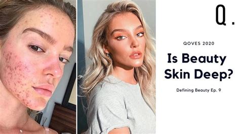 Why Unhealthy Skin Affects Your Appearance What Makes A Face