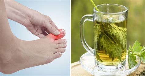 10 Natural Remedies That Can Help Alleviate Your Gout Symptoms