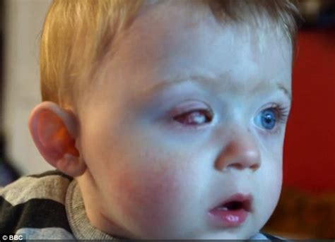 Toddler Left Blind In One Eye After Drone Propeller Sliced His Eyeball