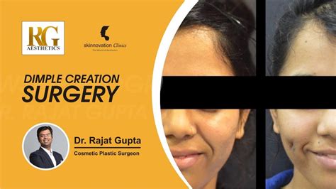 Dimple Creation Surgery Step By Step Teaching Video Plastic Surgeon