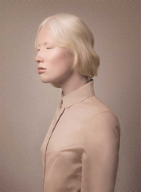 Living With Albinism Nude By Justine Tjallinks Dodho