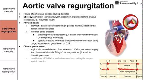 Aortic Stenosis With Regurgitation