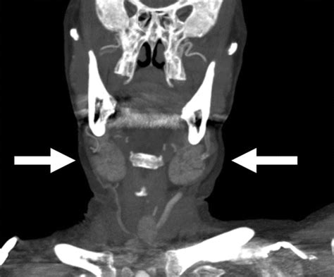 Case 277 Iodide Mumps Radiology