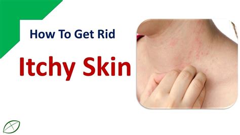 How To Get Rid Of Itchy Skin Stop Itchy Skin With Oatmeal And Cool