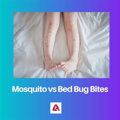 Difference Between Mosquito And Bed Bug Bites