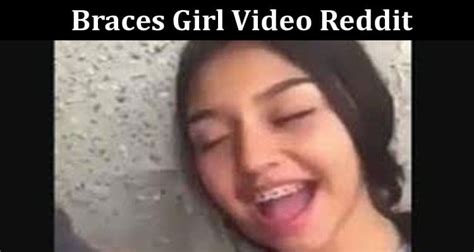 Full Video Link Braces Girl Video Reddit Check What Is In The Braces Girl Video Viral On