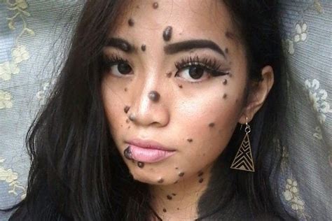 This Miss Universe Malaysia Contestant Was Born With Moles