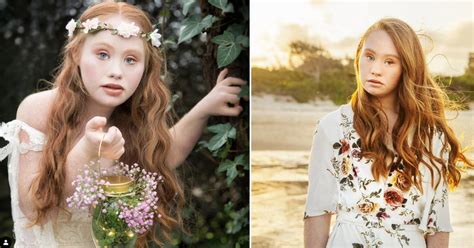 Madeline Stuart Became A First Model With Down Syndrome Inspiring