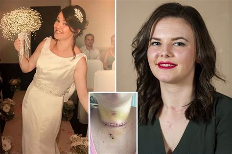 Newlywed 26 Discovers She Has Thyroid Cancer After Bumping Into Eagle