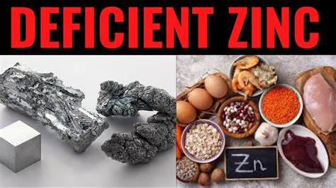 5 Important Signs Of Zinc Deficiency Youtube