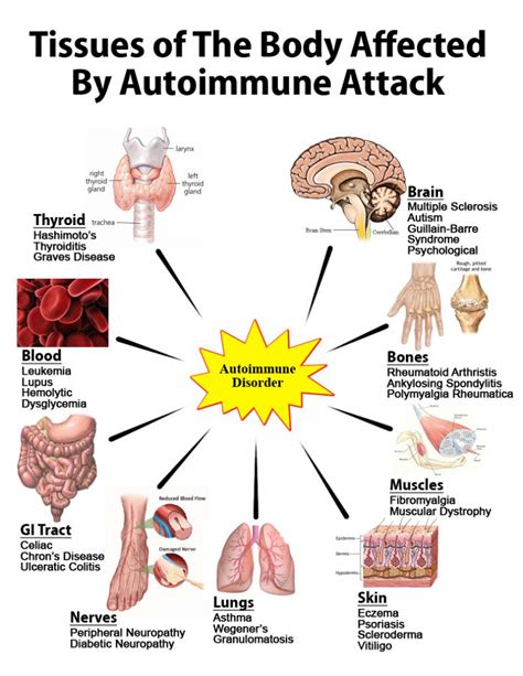 Autoimmune Disease Symptoms Health Over 70