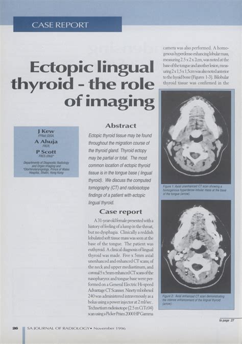 Pdf Ectopic Lingual Thyroid The Role Of Imaging
