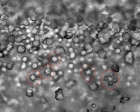Clytocybe Nébuleux (?) - Mycologie microscopique - Mikroscopia