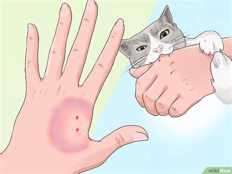 Examine the cat's bite wound. Cómo saber si una mordedura de mascota es grave