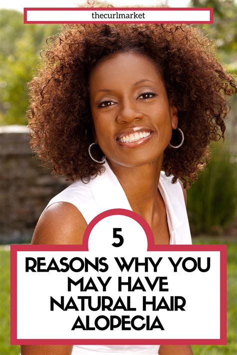 Alopecia In Natural Hair Heres What You Should Know To The Curl