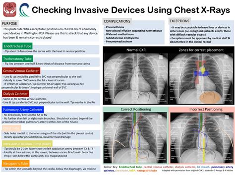 Checking Invasive Devices Using Chest X Rays Dr Grepmed