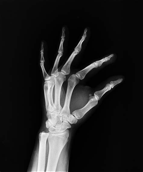 Download Free Photo Of X Rayhealtharmdoctorsmedicine From