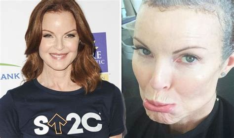Marcia Cross Desperate Housewives Star Opens Up About Rare Anal Cancer