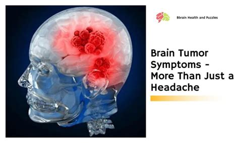 Brain Tumor Symptoms More Than Just A Headache Brain Health And Puzzles