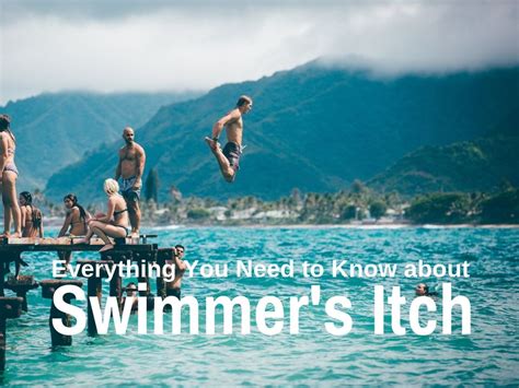 Everything You Need To Know About Swimmers Itch Tony Florida