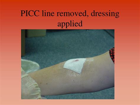 Drawing Blood Cultures From Picc Line